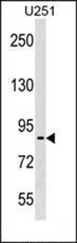 PES1 antibody