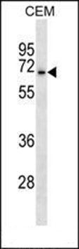 ACCN3 antibody