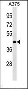 ANKRD63 antibody