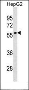 LRRC69 antibody