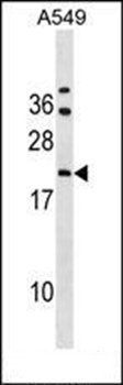 GRPEL2 antibody