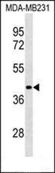 LRRC39 antibody