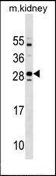 Tmem125 antibody