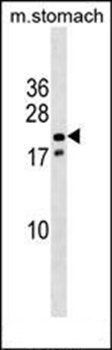 Nkx3-1 antibody