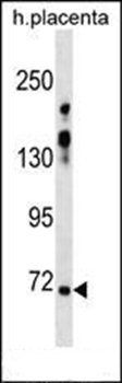 ZNF251 antibody
