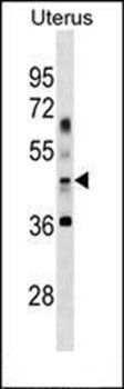 APG4B (G254) antibody