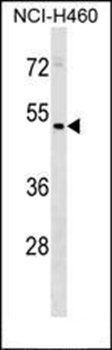HEPACAM2 antibody