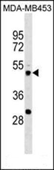 KCNAB1 antibody