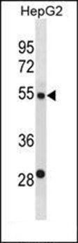 ST6GAL2 antibody