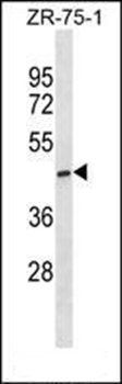 ST6GALNAC5 antibody