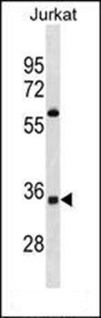 OR52A5 antibody