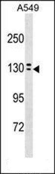 OVCH1 antibody
