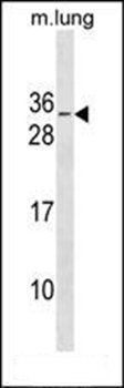 RBM7 antibody