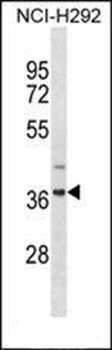 ZNF696 antibody