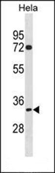 TIPIN antibody