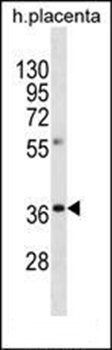 OR8A1 antibody