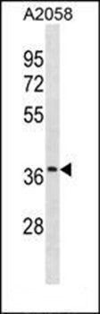 OR52J3 antibody