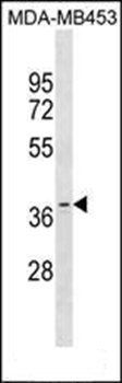 OR11A1 antibody
