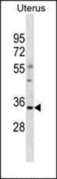 OR6S1 antibody