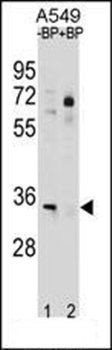 ATP1B2 antibody