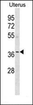 OR5W2 antibody