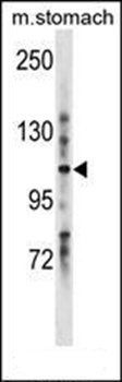 LRIG1 antibody