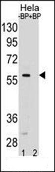 SMAD5 antibody