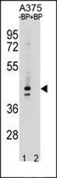OR5AC2 antibody