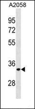 ELOVL3 antibody