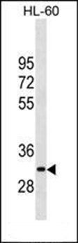 MMP26 antibody