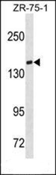 TIAM1 antibody