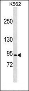 CLCN5 antibody