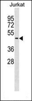 SERPINB8 antibody