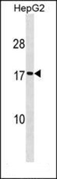 SC11A antibody