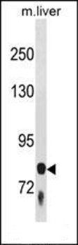 F13B antibody