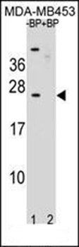 SSX6 antibody