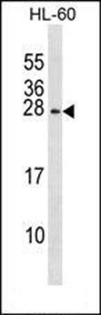 RGS2 antibody