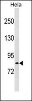 LRCH1 antibody