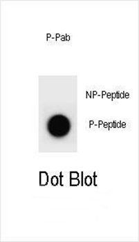 PTEN (phospho-Y176) antibody