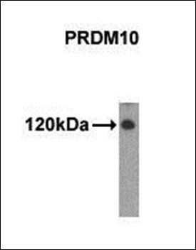 PRDM10 antibody