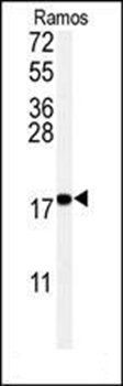 UBC9 antibody
