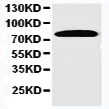 Anti-Nicastrin/NCSTN Antibody