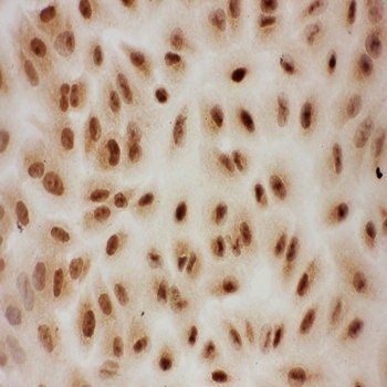 Anti-E3 SUMO-protein ligase PIAS1 PIAS1 Antibody