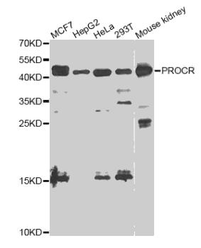 EPCR antibody