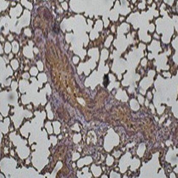Cathepsin D Antibody