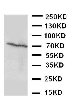 Estrogen Receptor beta/ESR2 Antibody