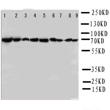 Hsp70/HSPA1A/HSPA1B Antibody