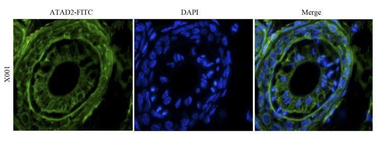 ATAD2 antibody (FITC)