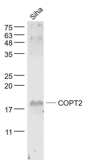 COPT2 antibody