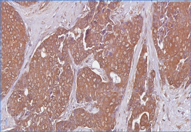 HS6ST2 Rabbit Polyclonal Antibody